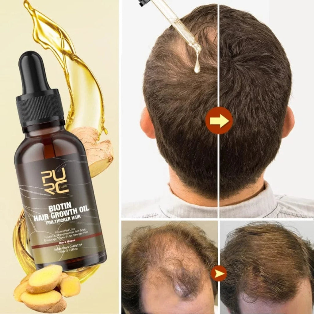 Biotin Hair Growth Oil